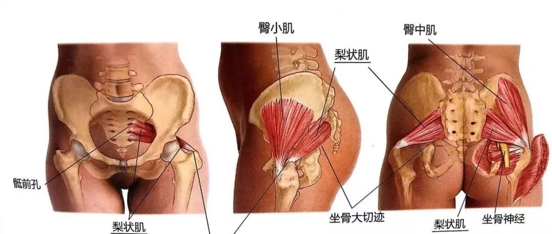 腰腿痛不一定是腰突！7种方法检查你的梨状肌